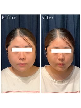 たくろう鍼灸院 豊田本院/Before&After