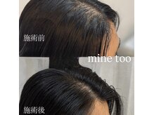 マイントゥー(mine too)の雰囲気（ハイパワーマシンと高濃度漢方なの力で効果を実感！育毛促進！）