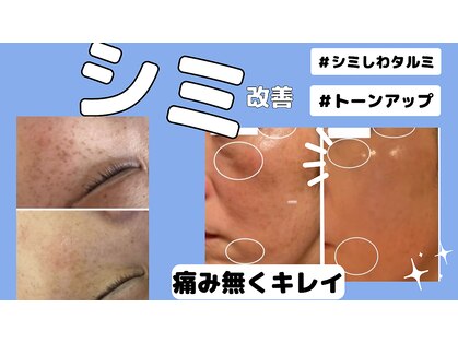 ミライ(Mirai)の写真