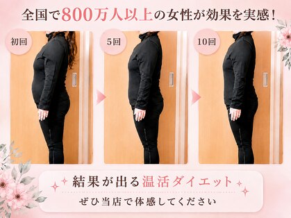 ヨサパーク ビリュウ(YOSA PARK Bellyu)の写真
