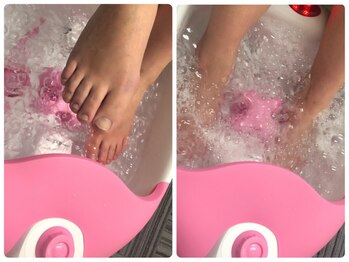 コルン/ハンド施術中も足浴可♪