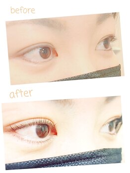 タオ(TAO)/ラッシュリフト(上下)