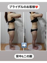 シャイニング(shining)/