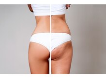 アイリス 川崎/【セル脂肪撃退】下半身