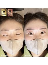 アイリー(IRIE)/ハリウッドブロウリフト