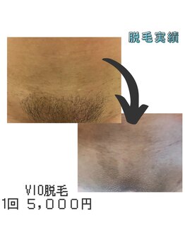 エンハンス 亀有(enhance)/脱毛実績