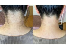 ティンク(Tink)/うなじワックス☆Before→After