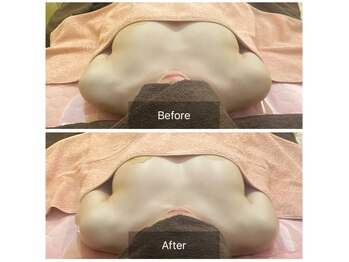 ベンザイ 新潟店(BENZAI)/左右差、下垂、谷間、水着が◎