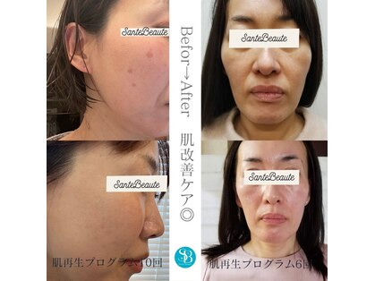 サンテボーテ(Sante Beaute)の写真
