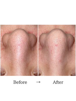 グラシア(gracia)/シミ・毛穴ケア専門店gracia