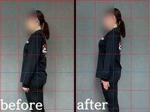 ヴレ 福岡店(Vraie)/猫背、ストレートネック解消