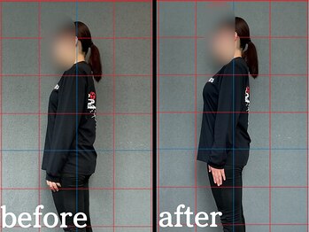 ヴレ 福岡店(Vraie)/猫背、ストレートネック解消