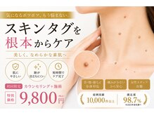 マーヴェラス(Marvelous)