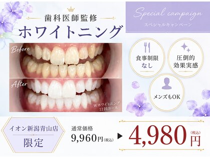 ホワイトニングカフェ イオン新潟青山店(WhiteningCafe)の写真