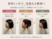 整音(totonone)