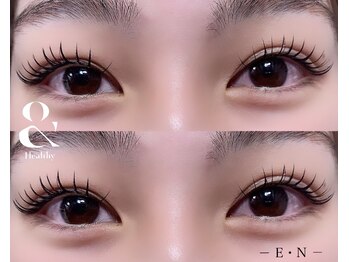 エン(E N)/アンドヘルシー