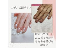 ネイルエデン サロン(NAIL EDEN SALON)の雰囲気（深爪ケア１６０００→１２０００別途ホームメンテ料あり）
