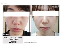 シズク ビューティーサロン(SHIZUKU beauty salon )/