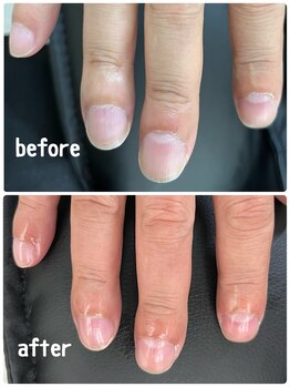 メンズネイルケア