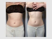 カロン 銀座(Kalon)/【腸もみ90分】20回結果！