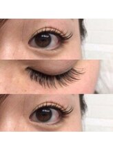 ブロッサ(Blossa)/フラットラッシュ140本