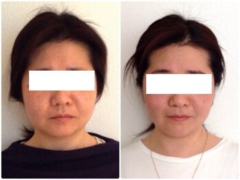 美容整体ウェリナ 中川八田院/小顔矯正/骨盤矯正/美脚サロン