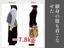 県庁通り整体院/細身の服も着こなせた/浦和/痩身