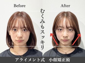 アライメントトウキョウ 恵比寿(Alignment TOKYO)/大きさ改善♪