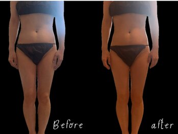 グランツ(glanz)/足から姿勢×リンパで美脚くびれ