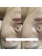 サロン フィオーレ(salon fiore)の写真/レチノールピーリングで毛穴・たるみケア!目指すは、内側から輝くハリツヤ肌へ♪