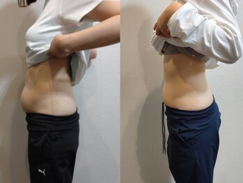 ヨガ アンド リラクゼーション からだの恵み 安城サロン/40代フィットカービング7回週2回