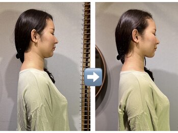 キワミ(KIWAMI)/＃首専門＃首こり＃首コリ＃整体