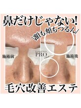 ルネッタ(Lunetta)/