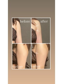 イーストモア(EAST MOIS)/ふっくらバストへ