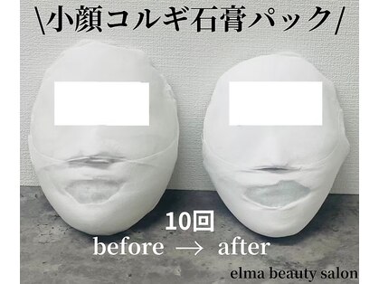 エルマ(elma)の写真