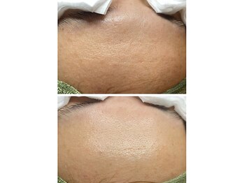 サイ(Sai)/before⇒after