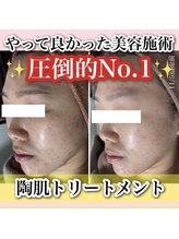 アルムダアクア 天王寺店(Aleumda AQUA)/ハーブピーリング/大阪/天王寺