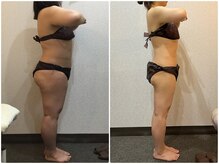 美容整体ウェリナ 中川八田院/小顔矯正/骨盤矯正/美脚サロン