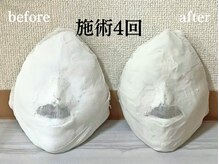 コルギサロン 伏見店(k_korugi.salon)/お顔をの左右差が気になる方に◎