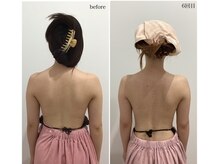 ビューティーサロン シンデレラ 心斎橋本店(Cinderella)/バストケアで叶う背中美人♪