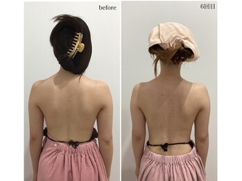 ビューティーサロン シンデレラ 心斎橋本店(Cinderella)/バストケアで叶う背中美人♪