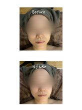 ネリネ(Nerine)/【小顔】コルギ