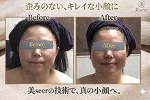 小顔アンドエイジングケア専門店 ビゼ(美sser)
