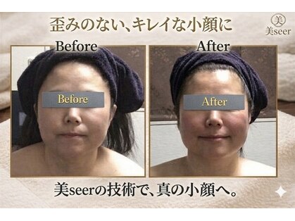 小顔アンドエイジングケア専門店 ビゼ(美sser)の写真