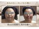 小顔アンドエイジングケア専門店 ビゼ(美sser)の写真