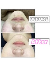 ハリリーナプラス(Haririna PLUS+)/毛穴レスな美肌に！