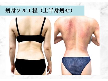 リメイク 銀座(REMAKE)/★痩身フル工程