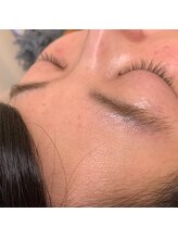 ミメル バイ ラフォンテ(mimelle by LAFONTE)/フェイシャルワックスエステ