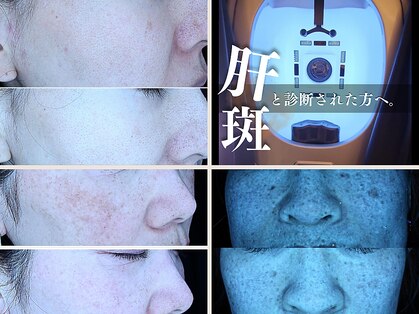 The水光美肌専科の写真