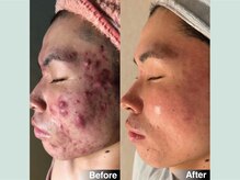 韓美 表参道店(HANMI)/